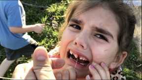 FAIL! Kids Pull Loose Tooth With Rocket!